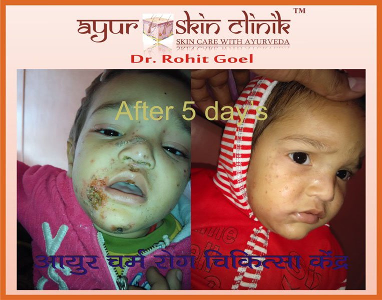 Before and after cosmetology treatment result